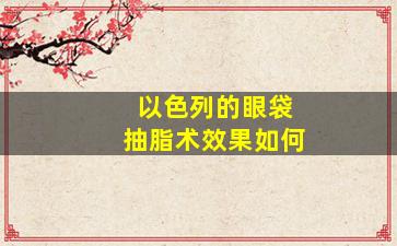 以色列的眼袋抽脂术效果如何