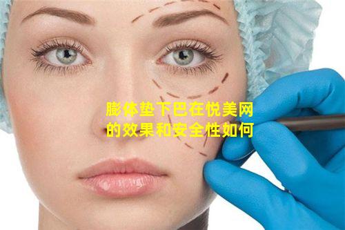 膨体垫下巴在悦美网的效果和安全性如何