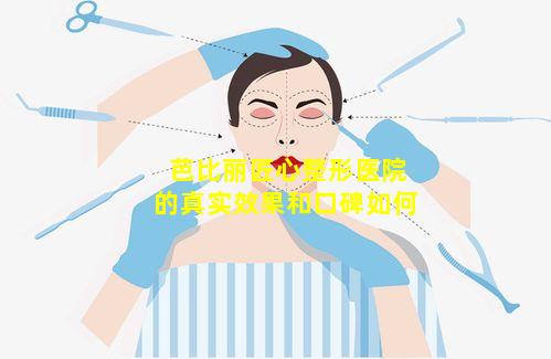 芭比丽匠心整形医院的真实效果和口碑如何