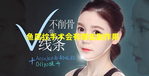 鱼尾纹手术会有哪些副作用
