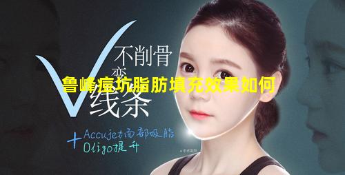 鲁峰痘坑脂肪填充效果如何